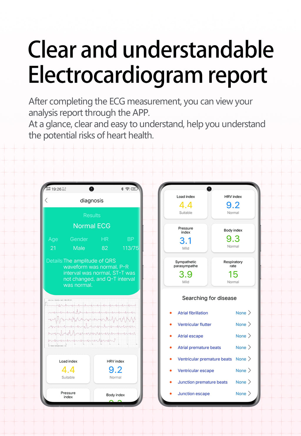 New smartwatch S17 airbag blood pressure monitoring NFC SOS ECG electrocardiogram Sport, blood sugar, uric acid, blood lipid, body temperature, blood oxygen, sleep monitoring, breathing training Lover gift