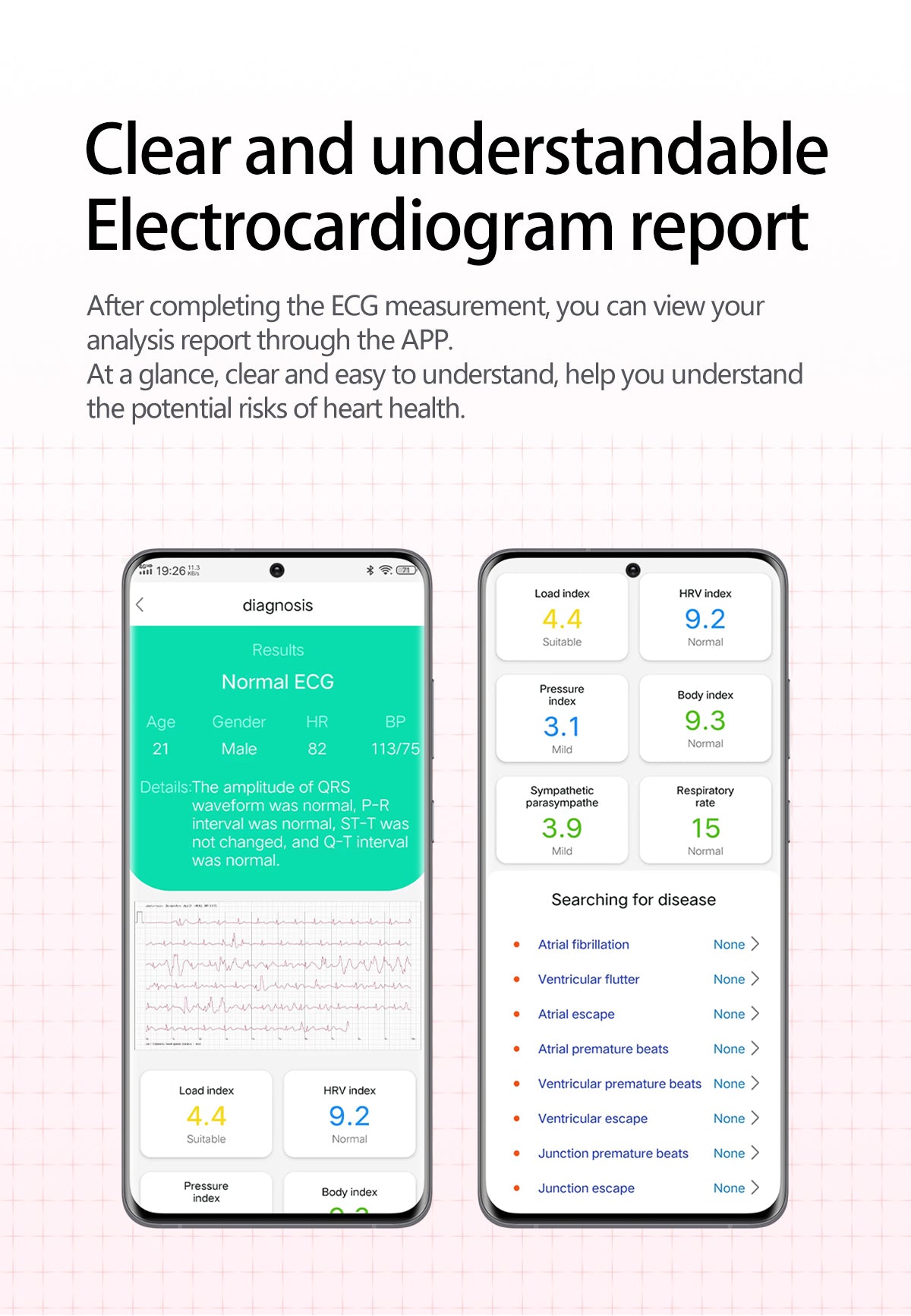 New smartwatch S17 airbag blood pressure monitoring NFC SOS ECG electrocardiogram Sport, blood sugar, uric acid, blood lipid, body temperature, blood oxygen, sleep monitoring, breathing training Lover gift