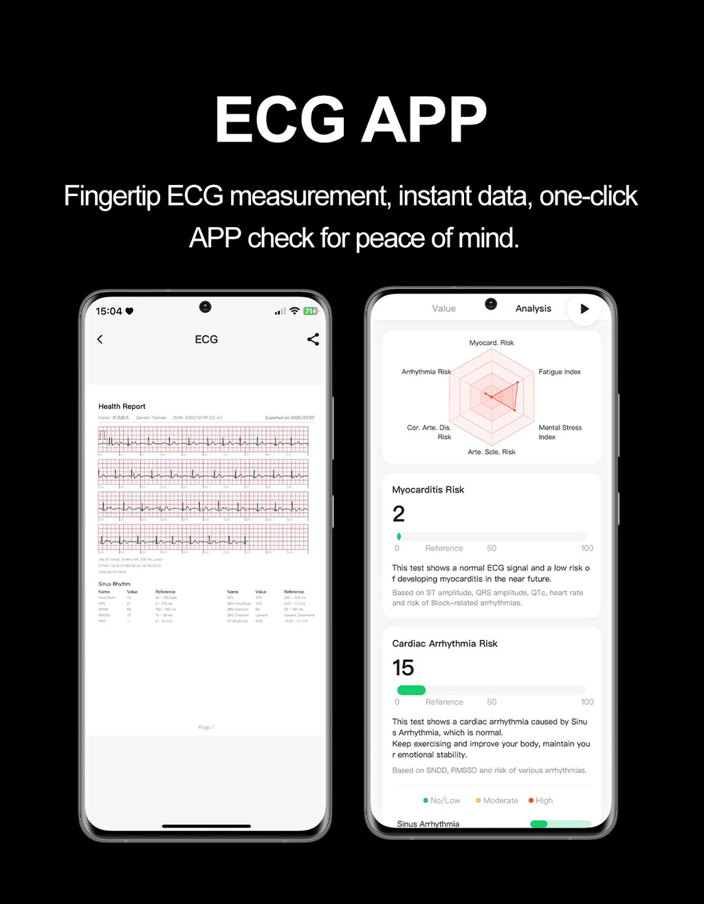 New smartwatch S101 lover's Gift,bluetooth call, health monitoring True blood pressure Air pump Blood glucose NFC ECG SOS