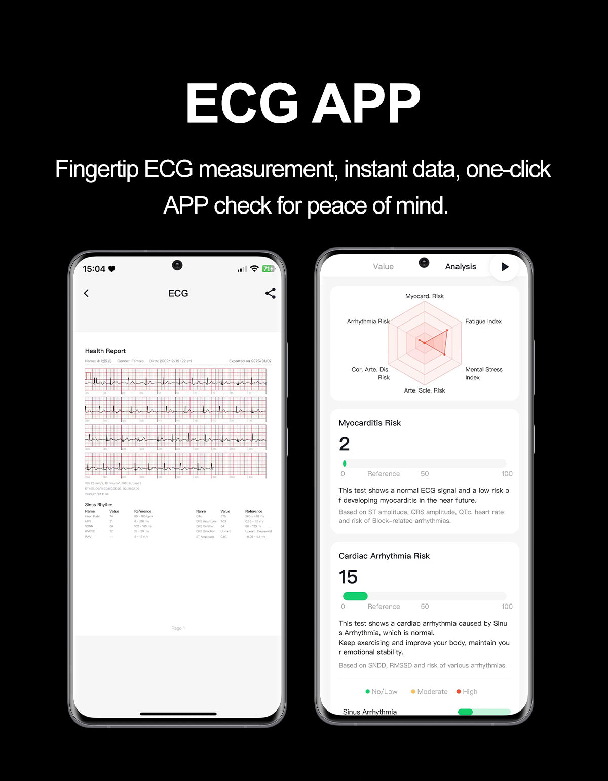 New smartwatch S101 lover's Gift,bluetooth call, health monitoring True blood pressure Air pump Blood glucose NFC ECG SOS